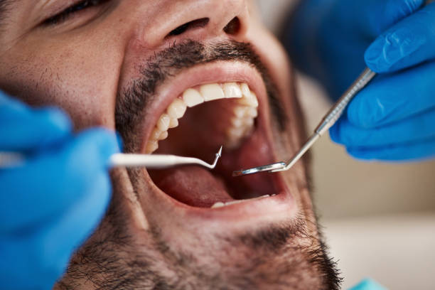 Best Emergency Broken Tooth Repair in Newpt, OR